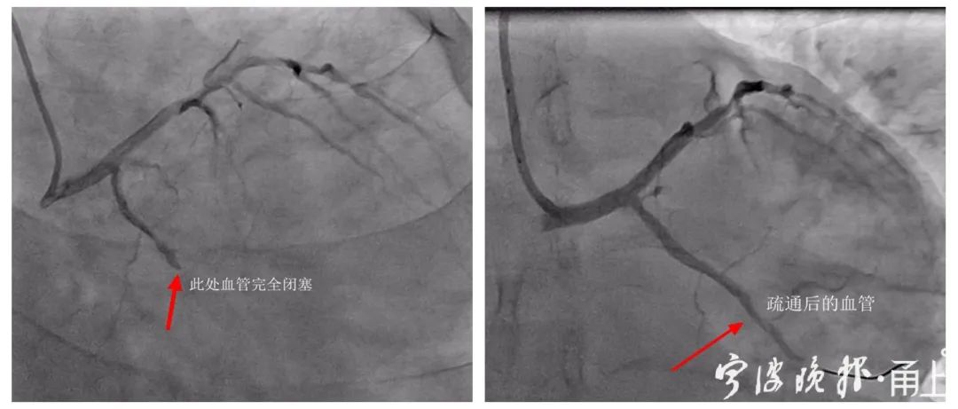 游戏玩到凌晨3点宁波27岁男子突然胸痛 有医院一周连收4例休闲区蓝鸢梦想 - Www.slyday.coM
