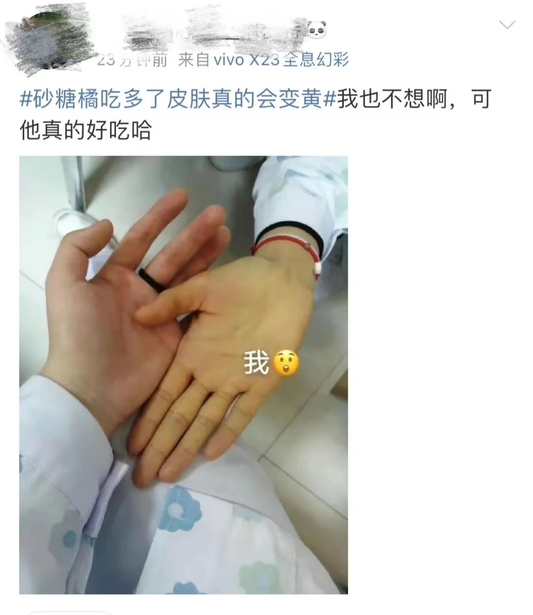 “没有一袋砂糖橘能过夜”冲上热搜！吃多了，皮肤真的会变黄休闲区蓝鸢梦想 - Www.slyday.coM