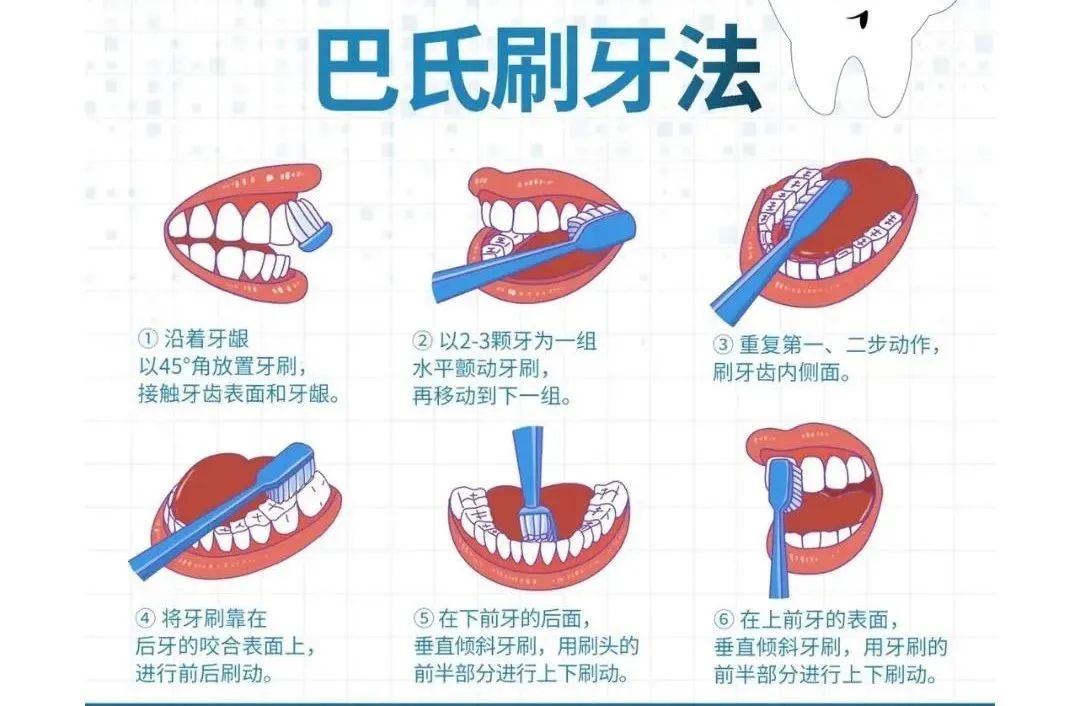 改良巴氏刷牙图片