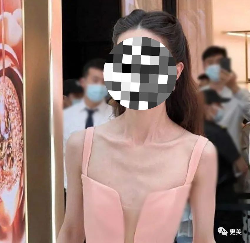 瞎减肥瘦出排骨胸变爽子2.0,可依旧发量惊人,让小鞠羡慕?|爽子_新浪新