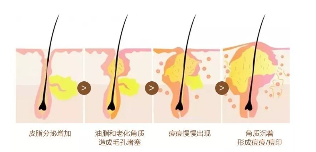 清爽控油护肤品哪种好 宋词水乳好用吗