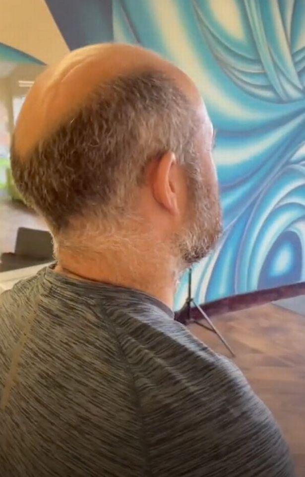 "作为一个脱发女孩,我真的能体会发型对生活的改变有多大,伟大的发型