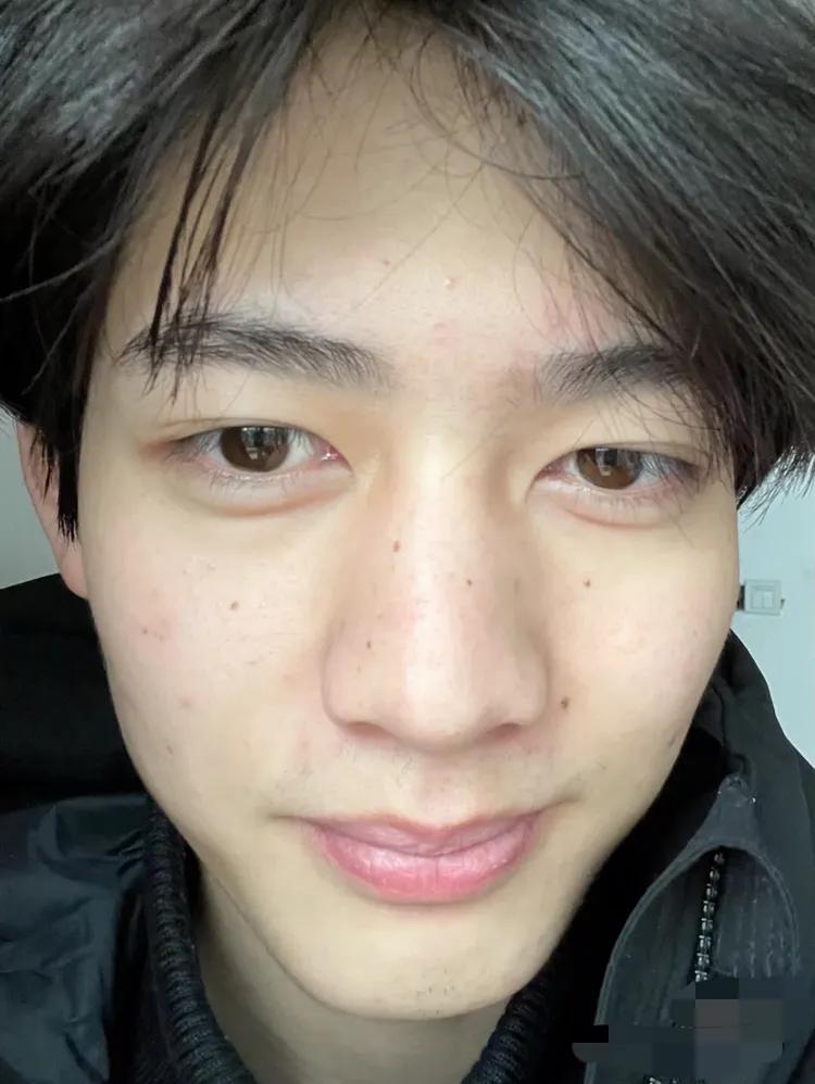 这还是男版杨超越甘望星素颜怼脸自拍瑕疵明显判若两人