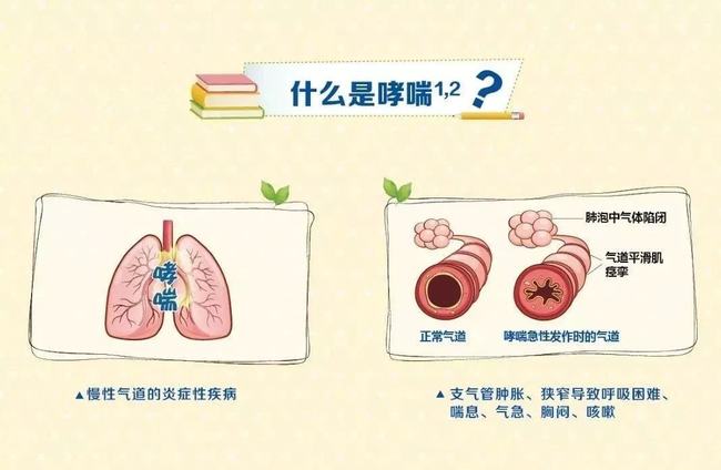小儿推拿杨晓:冬季儿童哮喘进入高发期,如何识别,应对及护理?