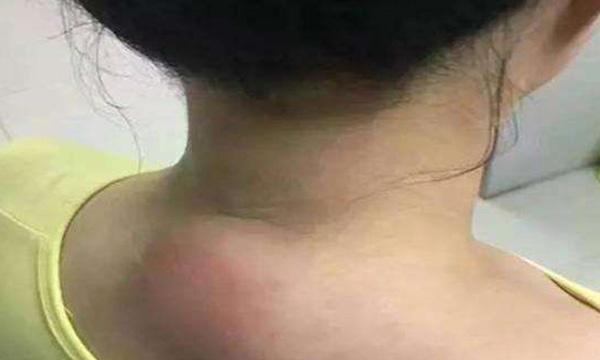 富贵|肩颈|脖子_新浪新闻