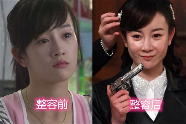 结婚了张檬金恩圣甜蜜合照好登对小五不介意张檬整容插足过往