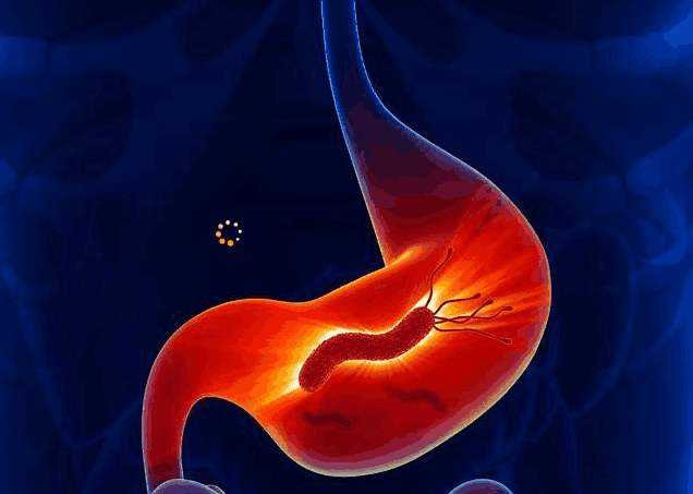 小儿推拿杨晓：儿童感染幽门螺杆菌的原因症状？需不需要检测治疗休闲区蓝鸢梦想 - Www.slyday.coM