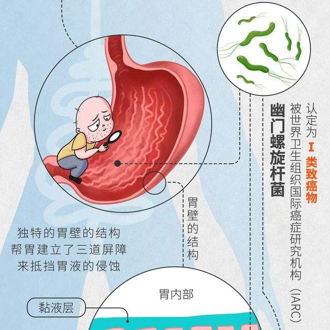 小儿推拿杨晓：儿童感染幽门螺杆菌的原因症状？需不需要检测治疗休闲区蓝鸢梦想 - Www.slyday.coM