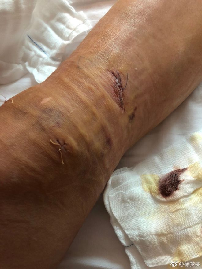 烧烤店里长大的奥运四朝元老!“退役”的她又带着满身伤痛来争冠休闲区蓝鸢梦想 - Www.slyday.coM 烧烤店里长大的奥运四朝元老!“退役”的她又带着满身伤痛来争冠休闲区蓝鸢梦想 - Www.slyday.coM