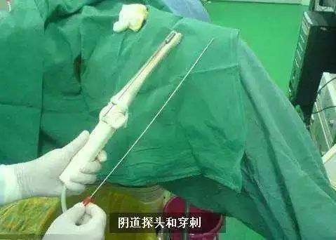 取卵的工具是一根长达30厘米,直径2毫米的钢针.