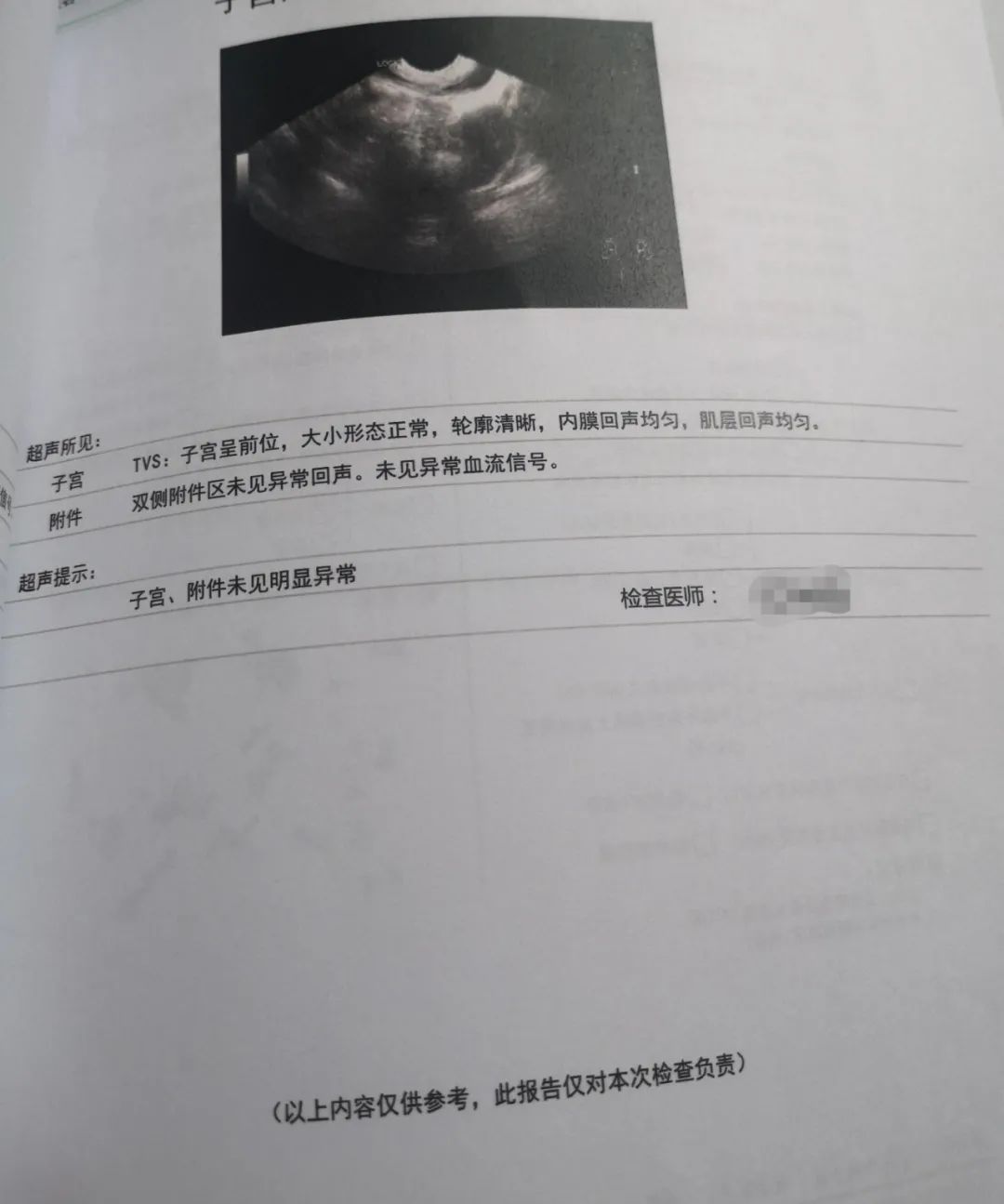 怀孕的检查报告单图片图片