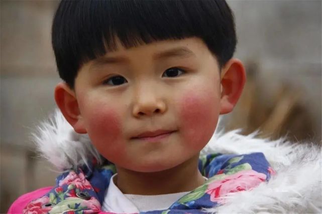 宝宝两颊发红注意御寒保湿