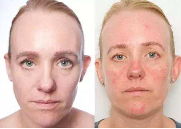 建议女生：拒绝这“3个”护肤坏习惯，不然你的皮肤会越变越差休闲区蓝鸢梦想 - Www.slyday.coM