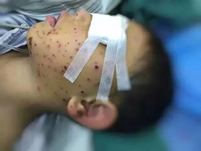 熊孩子玩鞭炮有多危险每个家长都该看看