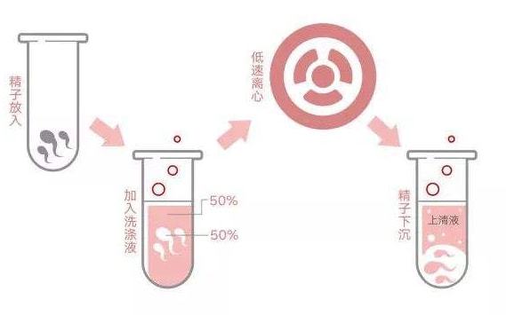 太硬核了嫌医院人工授精太贵英国女子购买针筒自行操作