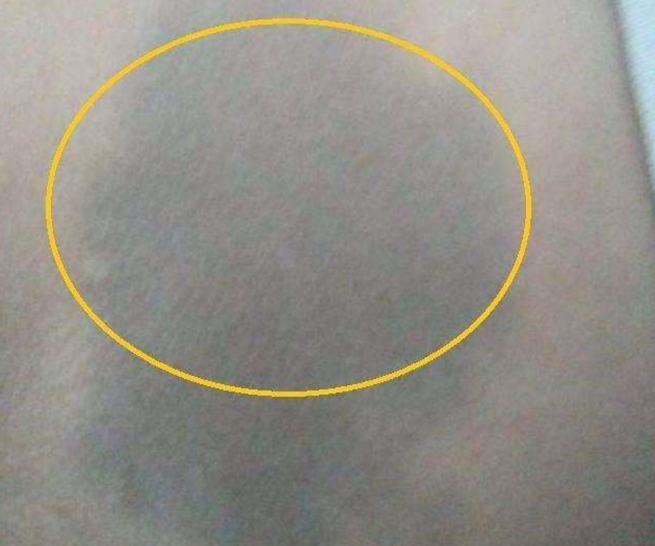 新生儿屁股的“淤青”,是被医生拍的吗?医生的回应把产妇逗笑休闲区蓝鸢梦想 - Www.slyday.coM 新生儿屁股的“淤青”,是被医生拍的吗?医生的回应把产妇逗笑休闲区蓝鸢梦想 - Www.slyday.coM