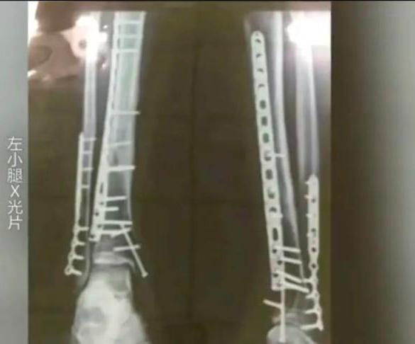 “钢铁侠”贾宗洋：自己拿不拿金牌都没有问题，只要是中国就可以休闲区蓝鸢梦想 - Www.slyday.coM