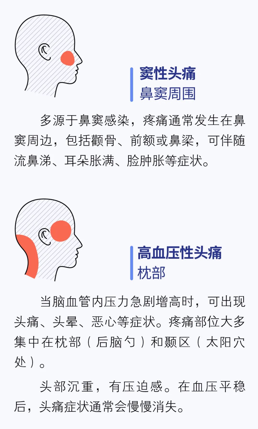 喝酒为什么头疼？