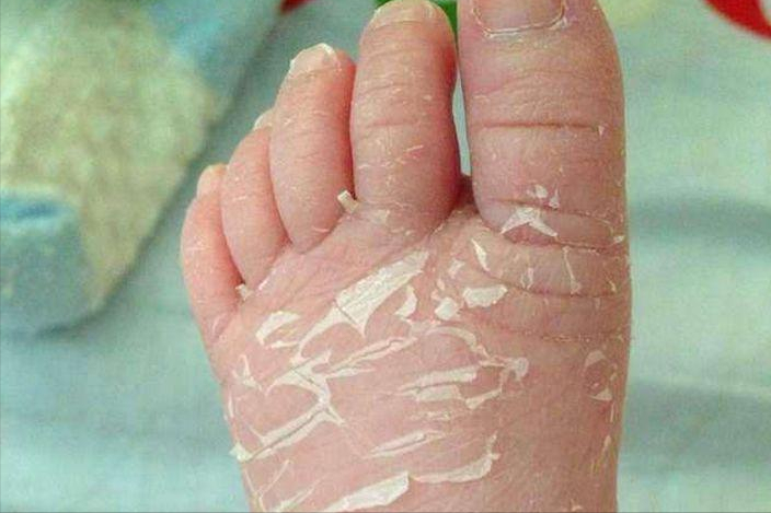 新生儿独有的5个“怪”现象,爸妈别着急,宝宝只是长得有点儿快休闲区蓝鸢梦想 - Www.slyday.coM 新生儿独有的5个“怪”现象,爸妈别着急,宝宝只是长得有点儿快休闲区蓝鸢梦想 - Www.slyday.coM