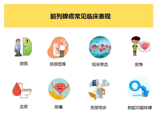 出现这些症状,需警惕前列腺癌!|前列腺癌_新浪财经_新浪网