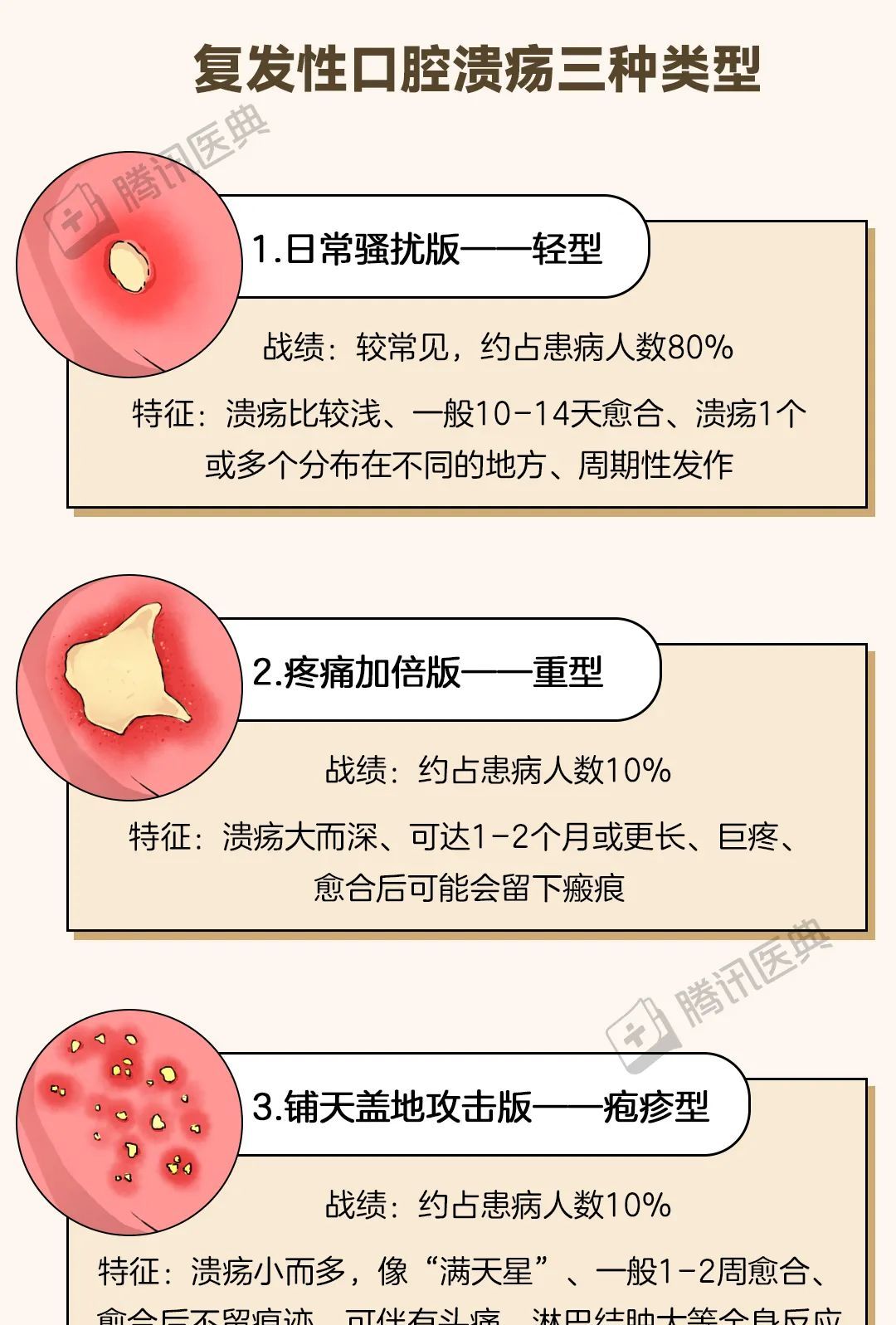 口腔溃疡老是反反复复会变成口腔癌吗