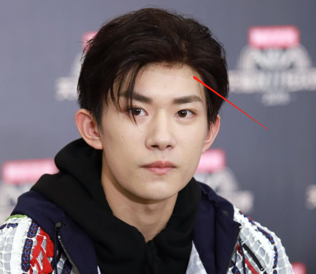 当红男星生图杨洋抬头纹易烊千玺戴假发蔡徐坤肖战皮肤好