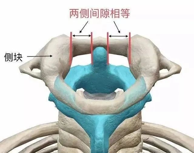 如果斜颈超过1个月,需要进行颅骨牵引,持续牵引2-3周之后,改用头环