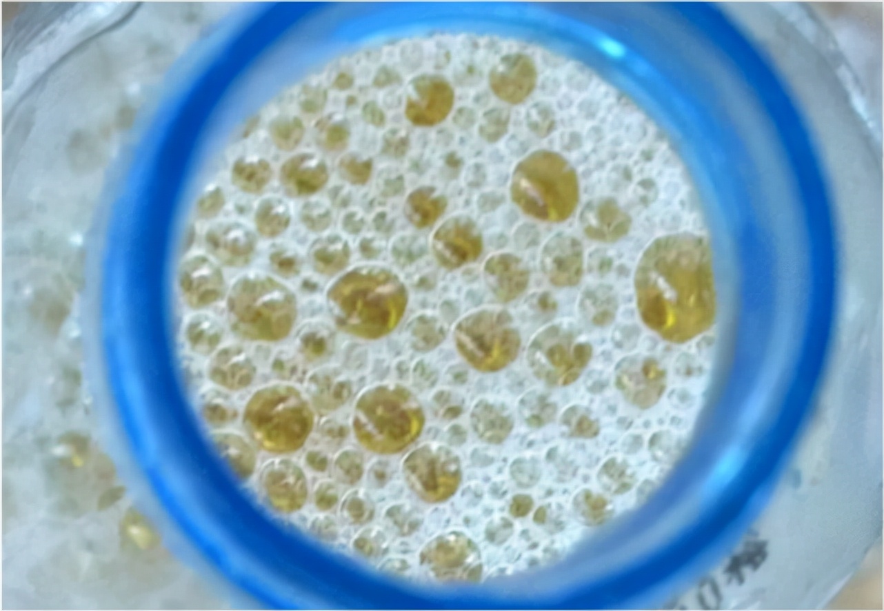 的情况,可能是体内尿酸值已超过"警戒线",尿酸值超标,形成尿酸盐结晶