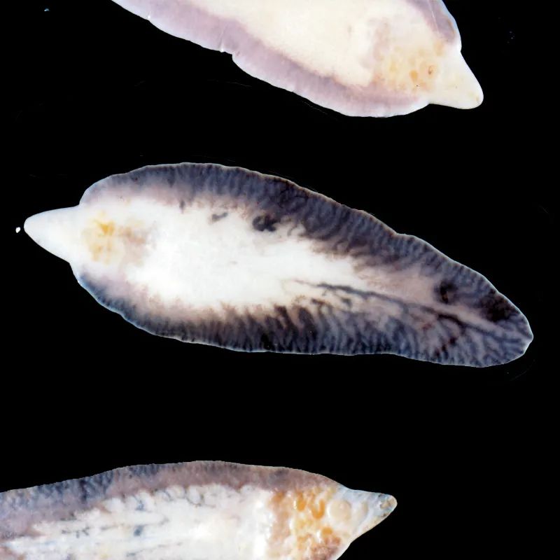 长3.5厘米！广西女子体内取出酷似“鱼”的虫子，是什么寄生虫？休闲区蓝鸢梦想 - Www.slyday.coM