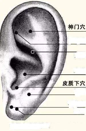 中医妙方耳朵上的这几个穴位可帮你消除术后疼痛