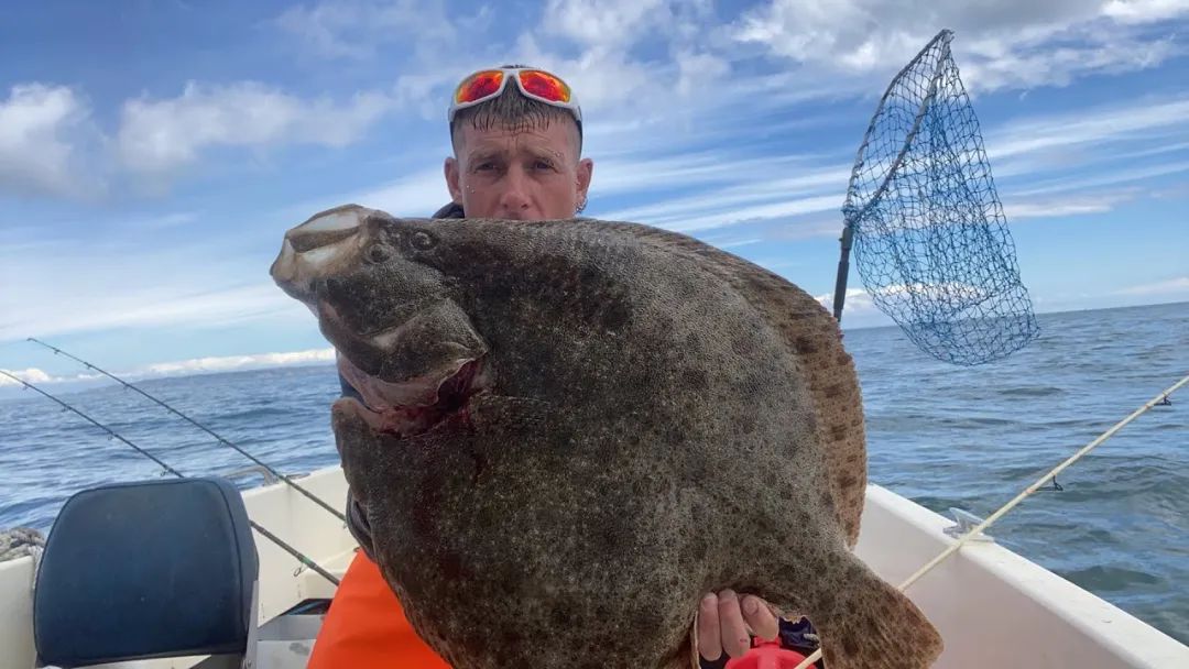 长3.5厘米！广西女子体内取出酷似“鱼”的虫子，是什么寄生虫？休闲区蓝鸢梦想 - Www.slyday.coM