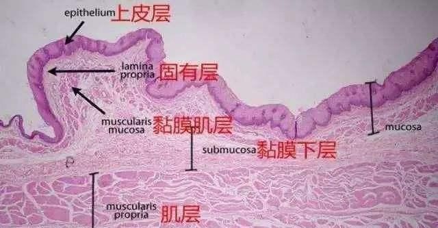 胃黏膜上皮是胃黏膜层内面部分,呈单层柱状上皮,下面的血色可以通过