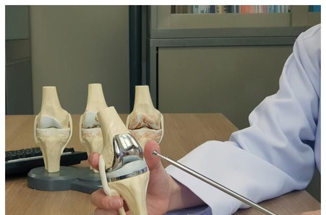 人工膝关节有使用寿命,万一要翻修怎么办?