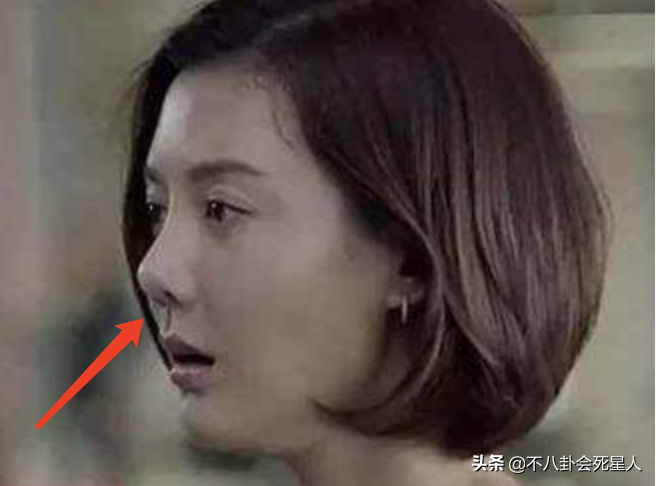 那些乱整鼻子的女明星还好吗后遗症一大堆杨幂金晨都开始崩了