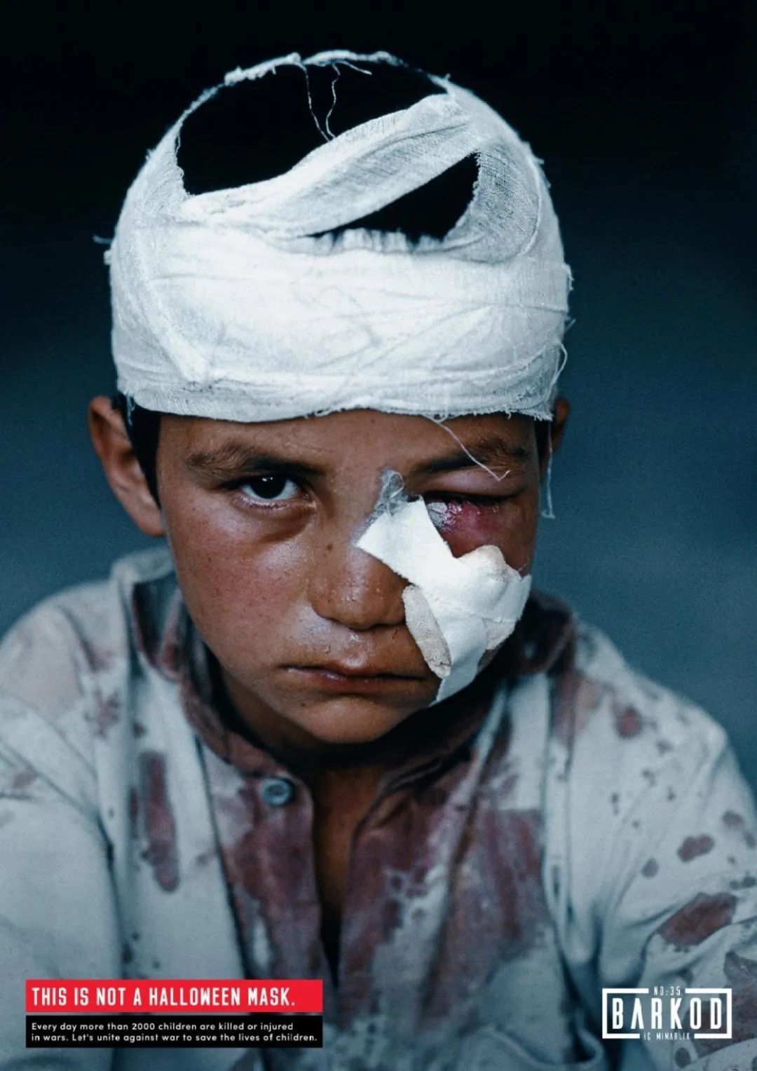 战争下的儿童悲惨图片