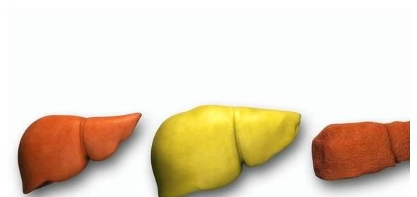 脂肪肝喝什么茶比较好?你或许真不知道,今天,来告诉各位答案