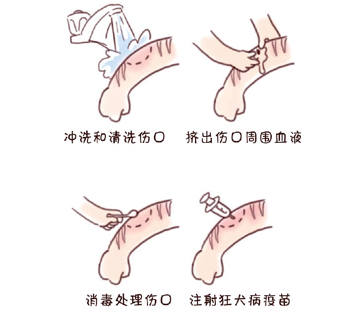被猫抓伤或被狗咬伤 第一时间这样做才是最要紧的休闲区蓝鸢梦想 - Www.slyday.coM