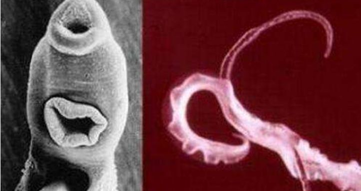 曹操真正败的并不是诸葛亮,而是一种疫病,这种疫病叫做吸血虫病,它