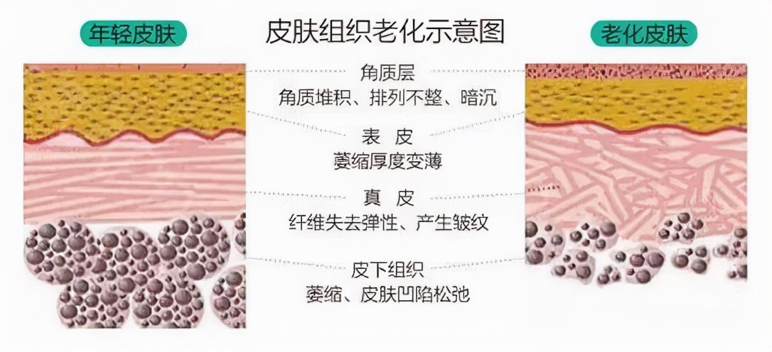 >>>怎麼高效處理不同分型的頸紋針對頸紋,比較常見的就是肉毒素和