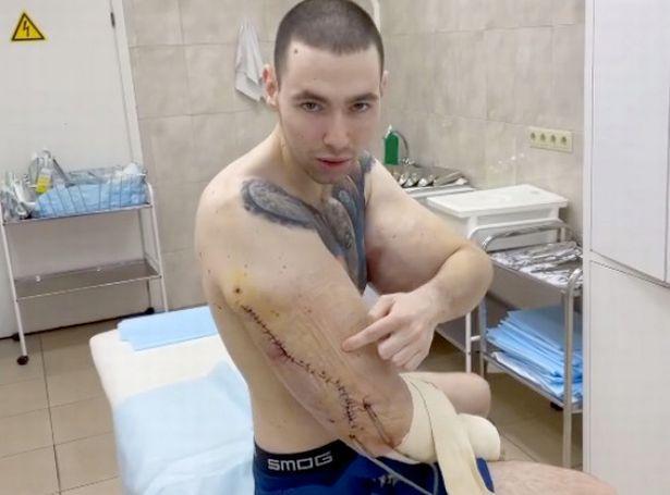 2019年,基里尔手臂扩张后还在笼子里与俄罗斯网络人格博主奥列格