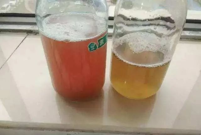 如果发现自己尿液中会存在一些血,而且伴随着疼痛感出现,在这种情况下