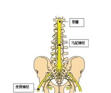 手术治疗马尾神经综合征,主要是解除突出物对神经的压迫,因每个患者