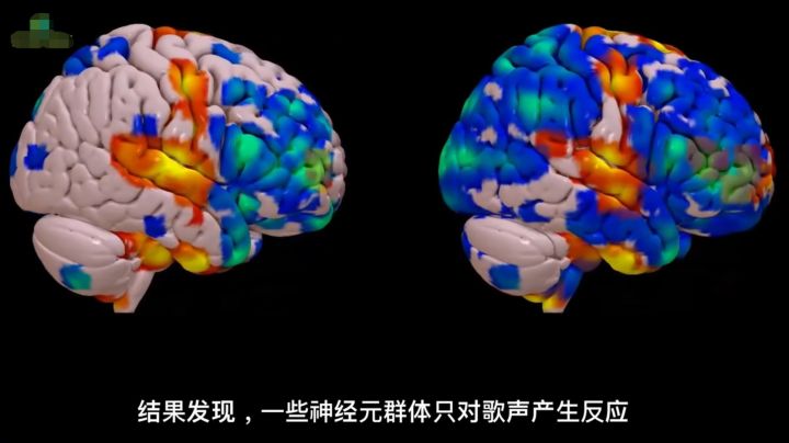 原来“音乐细胞”真的存在!科学家发现歌唱神经元,只对唱歌敏感休闲区蓝鸢梦想 - Www.slyday.coM 原来“音乐细胞”真的存在!科学家发现歌唱神经元,只对唱歌敏感休闲区蓝鸢梦想 - Www.slyday.coM