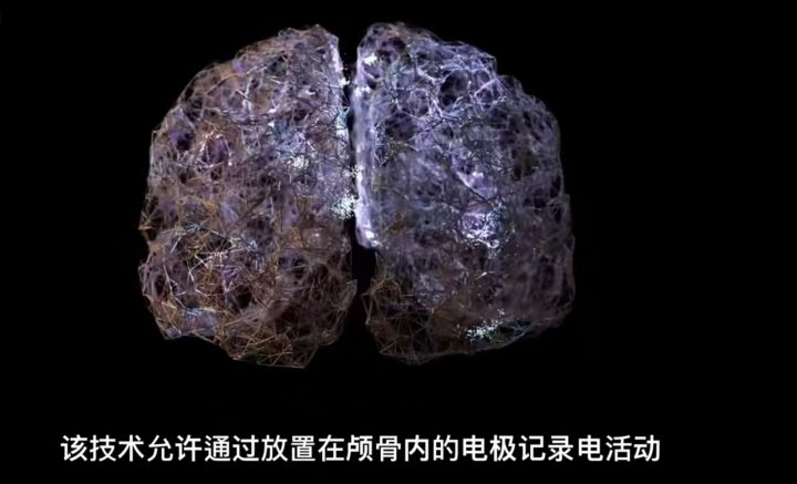 原来“音乐细胞”真的存在!科学家发现歌唱神经元,只对唱歌敏感休闲区蓝鸢梦想 - Www.slyday.coM 原来“音乐细胞”真的存在!科学家发现歌唱神经元,只对唱歌敏感休闲区蓝鸢梦想 - Www.slyday.coM