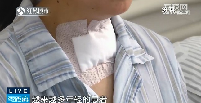 医院连续收治多位青少年甲状腺癌患者公认的致病因素竟是