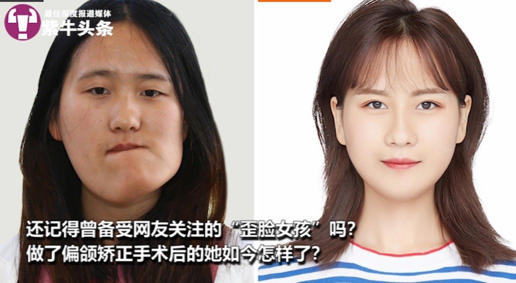 备受关注的"歪脸女孩"现状:通过了教资考试,为成为老师继续奋斗