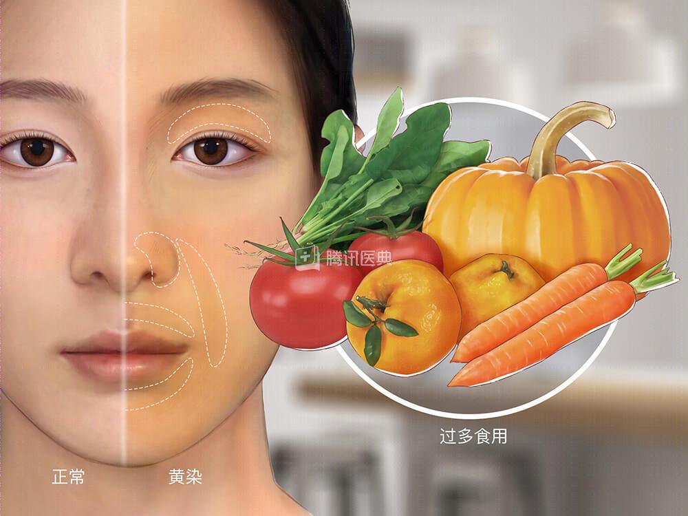 没错,吃橘子太多确实会变成"小黄人",使人变黄的现象叫做"橘黄症","