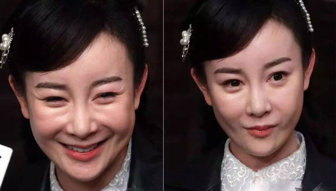 脸肿嘴歪笑不出来整容后的硅胶脸把这9位好演员害惨了