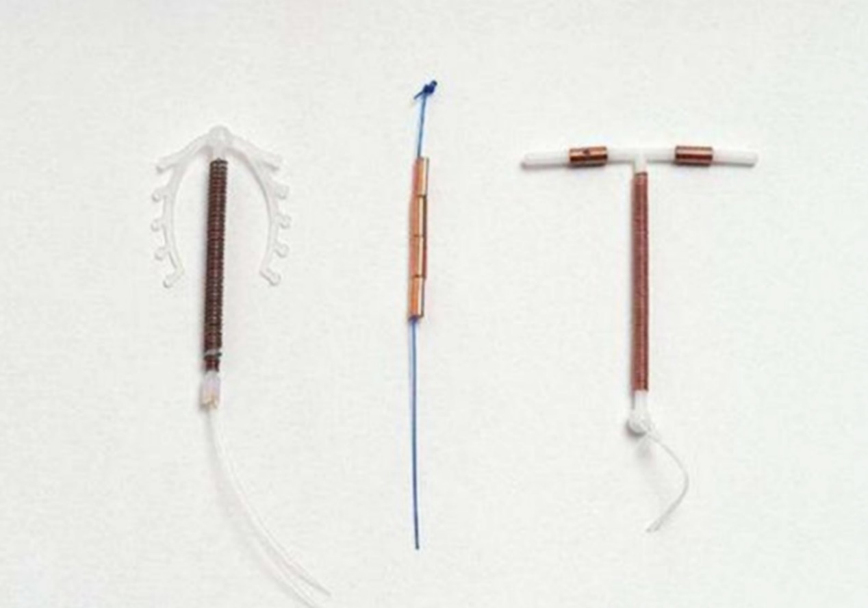 上环后被查出怀孕医生的解释让夫妻倍感尴尬结果也一言难尽