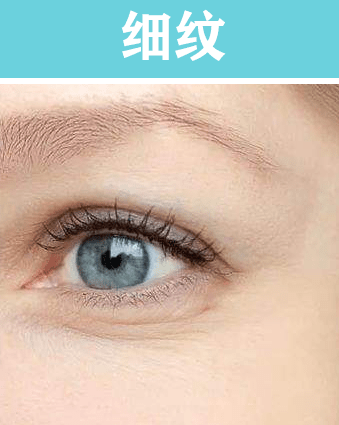 怎么去除干纹细纹皱纹的小妙招(配图)|美容院|细纹|皱纹_新浪新闻